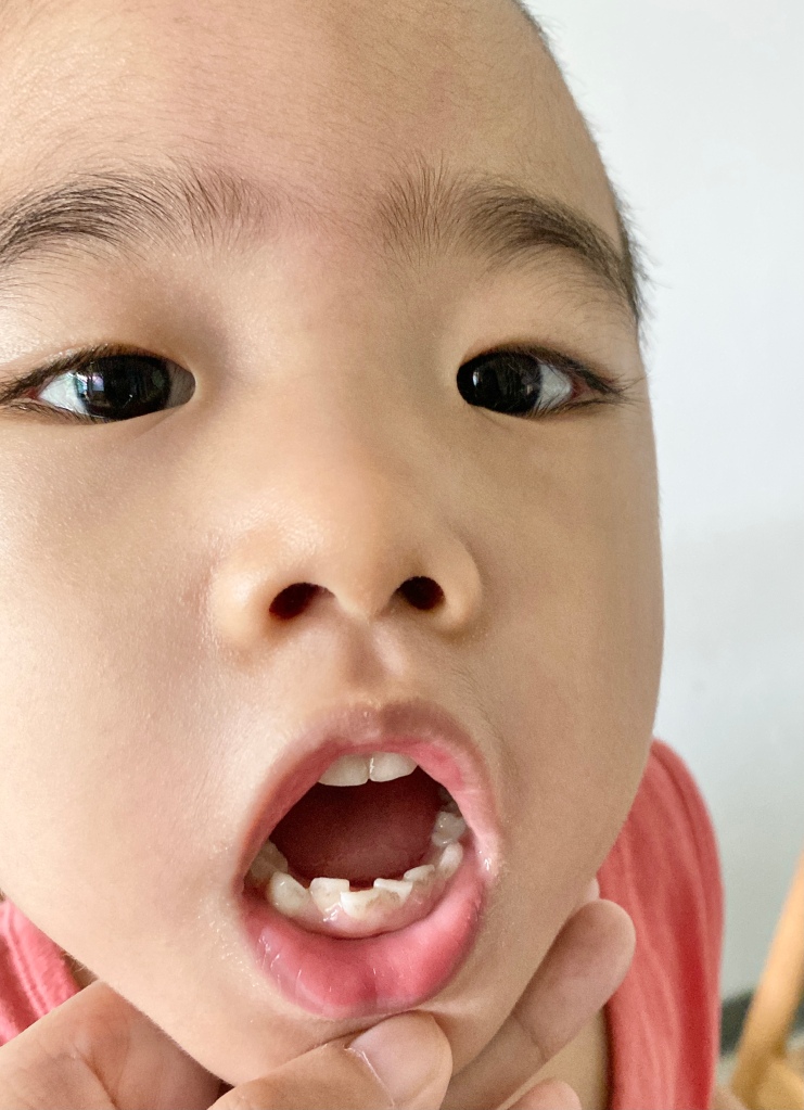 Toddler showing his teeth